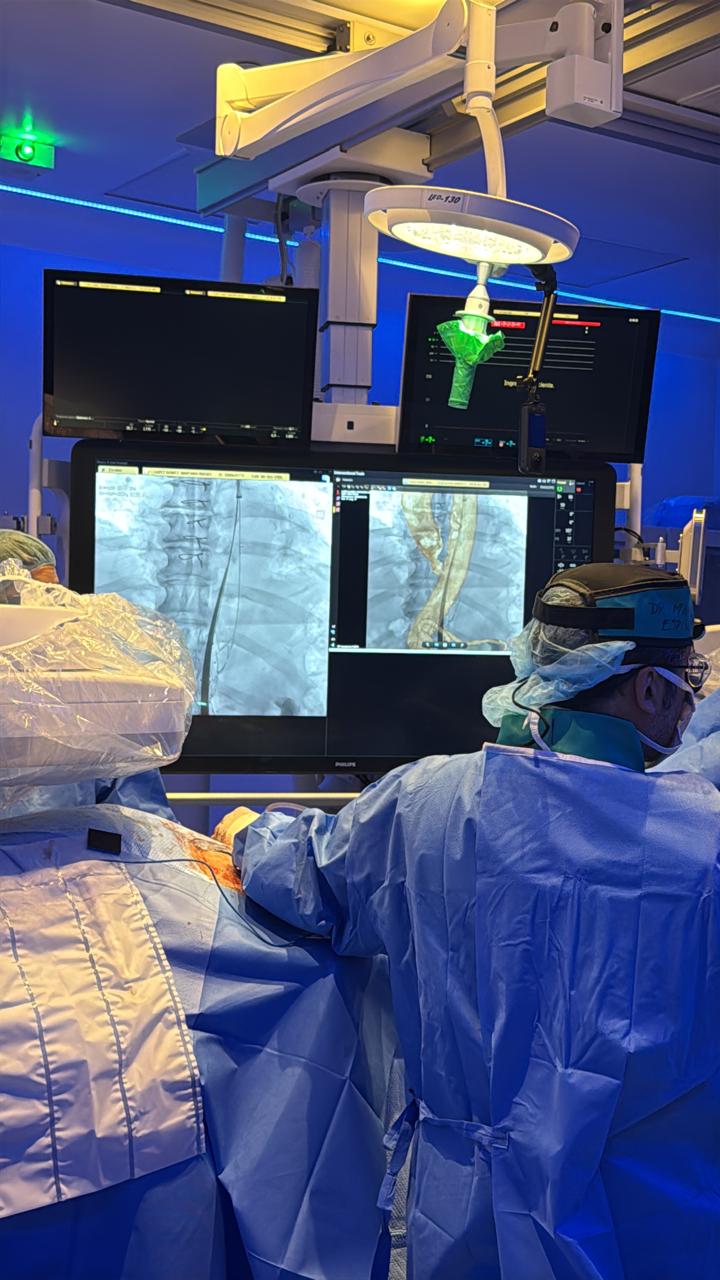 Cirugía Vascular EVAR Dr Espíndola