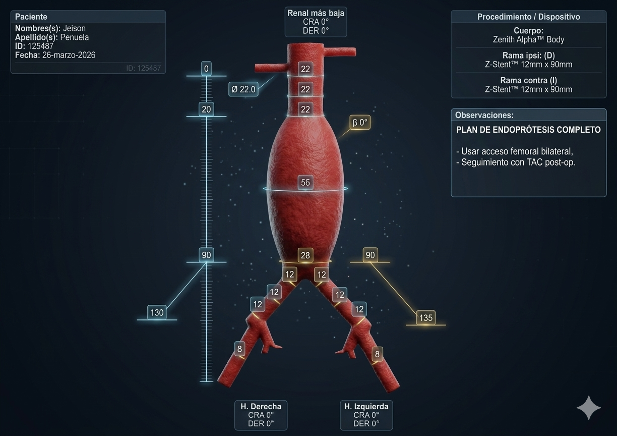 Resultado de planificación quirúrgica
